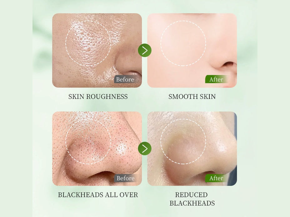 HUNMUI Whitening Exfoliating Gel 50g